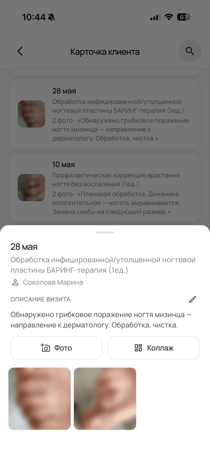 Фото до и после процедуры в карточке визита клиента